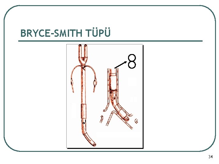 BRYCE-SMITH TÜPÜ 34 