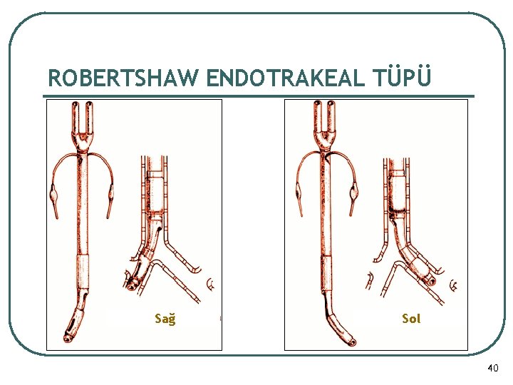 ROBERTSHAW ENDOTRAKEAL TÜPÜ Sağ Sol 40 