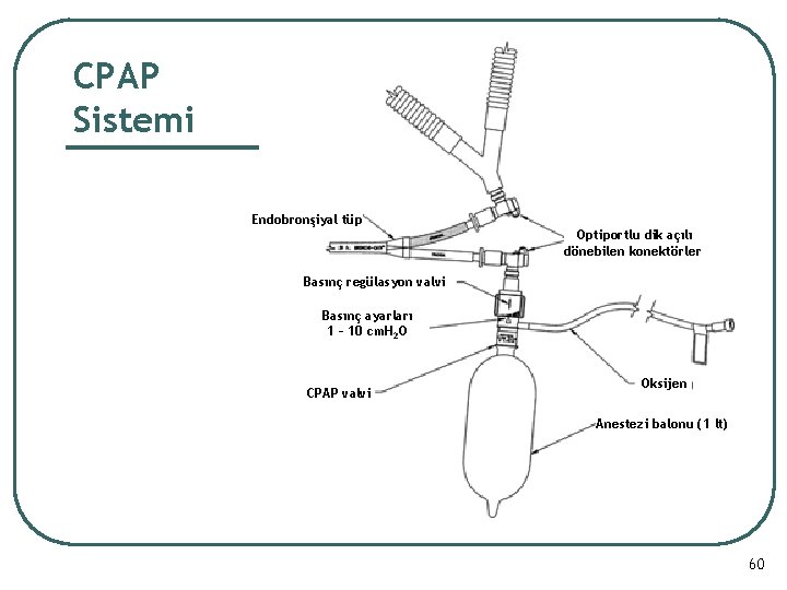 CPAP Sistemi Endobronşiyal tüp Optiportlu dik açılı dönebilen konektörler Basınç regülasyon valvi Basınç ayarları