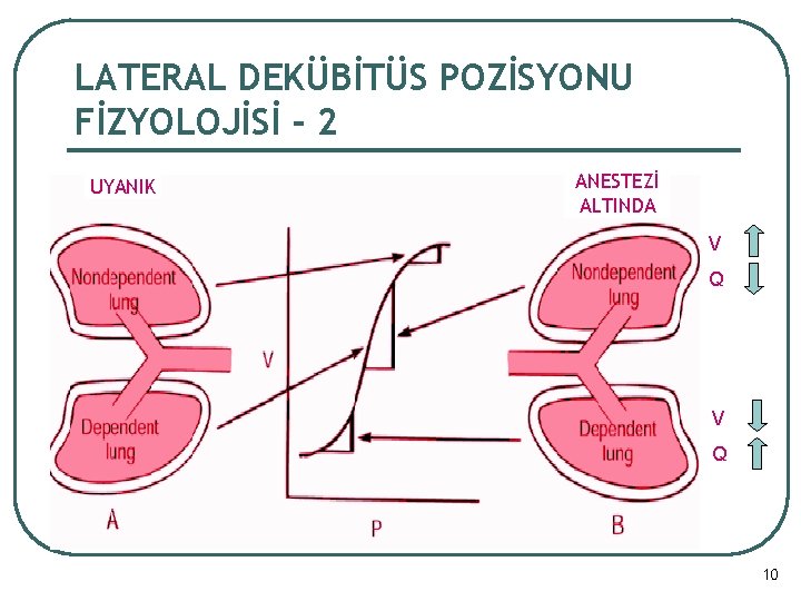 LATERAL DEKÜBİTÜS POZİSYONU FİZYOLOJİSİ - 2 UYANIK ANESTEZİ ALTINDA V Q 10 