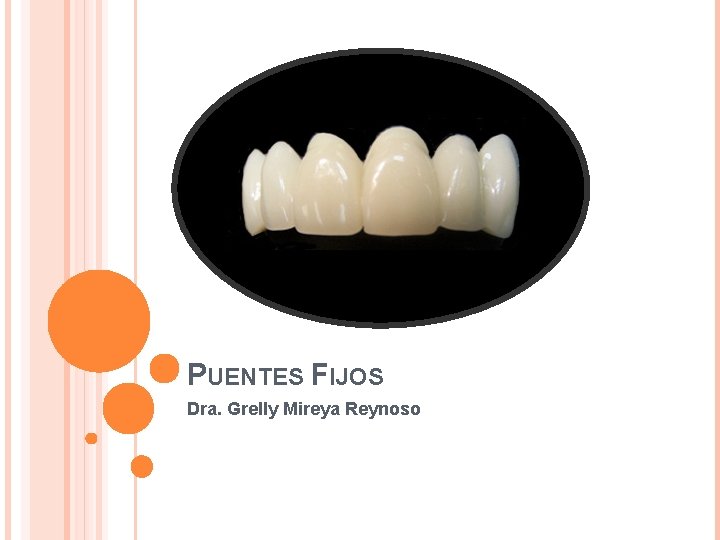 PUENTES FIJOS Dra. Grelly Mireya Reynoso 