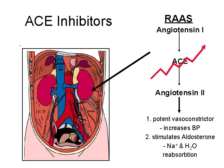 ACE Inhibitors RAAS Angiotensin I . ACE Angiotensin II 1. potent vasoconstrictor - increases