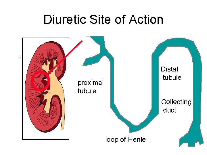 Diuretic Site of Action. Distal tubule proximal tubule Collecting duct loop of Henle 