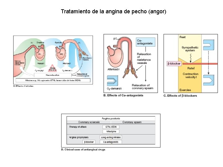 Tratamiento de la angina de pecho (angor) 