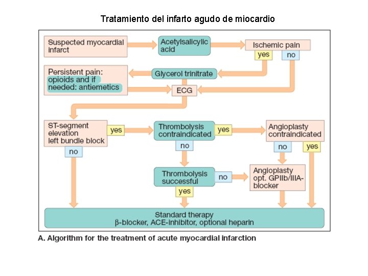 Tratamiento del infarto agudo de miocardio 