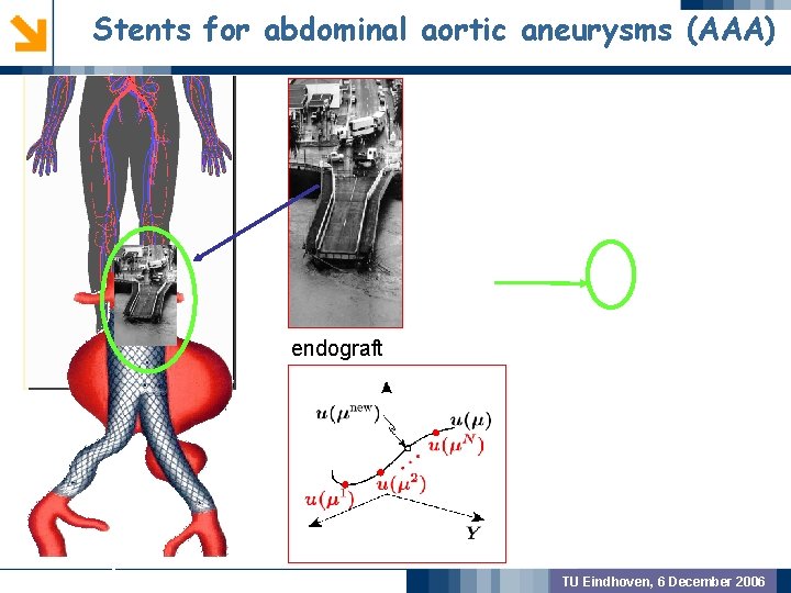 Stents for abdominal aortic aneurysms (AAA) GEOMETRIC PREPROCSSING MODEL VALIDATION endograft OUTCOME TU Eindhoven,