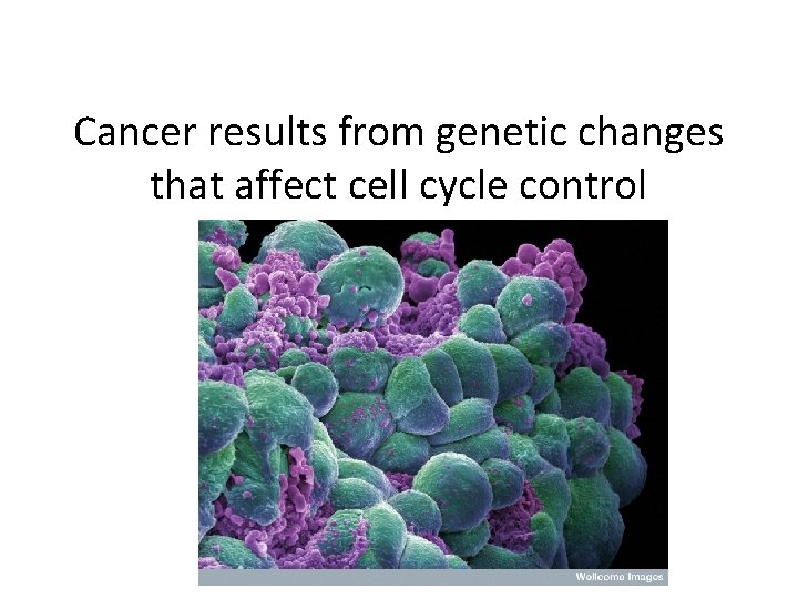 Cancer results from genetic changes that affect cell cycle control 