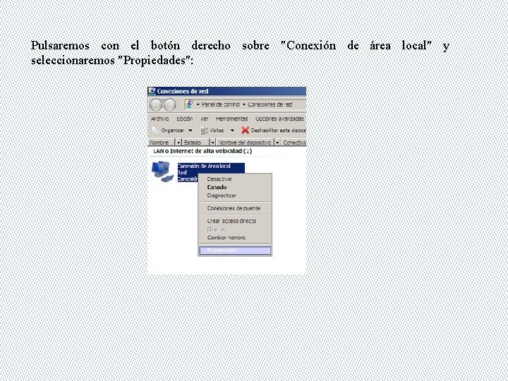 Pulsaremos con el botón derecho sobre "Conexión de área local" y seleccionaremos "Propiedades": 