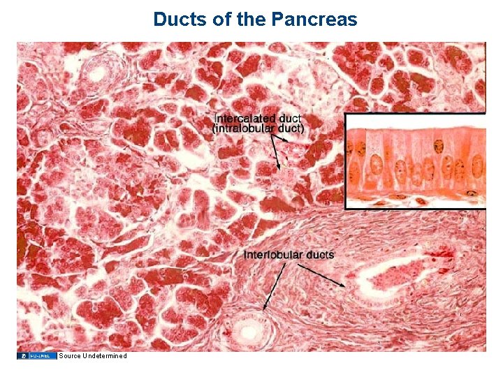 Ducts of the Pancreas Source Undetermined Ducts of the Pancreas Source Undetermined