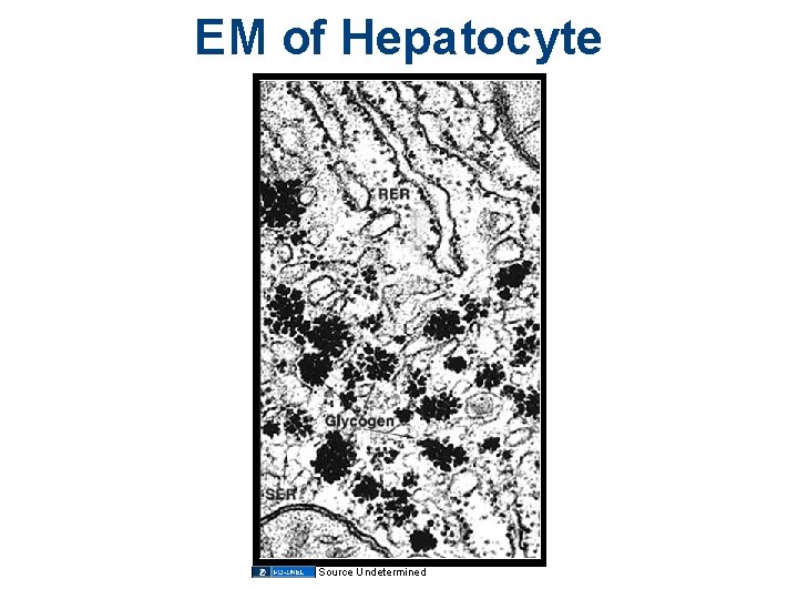 EM of Hepatocyte Source Undetermined 