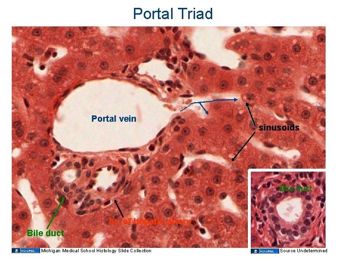 Portal Triad Portal vein sinusoids Bile duct br. of hepatic artery Bile duct Michigan