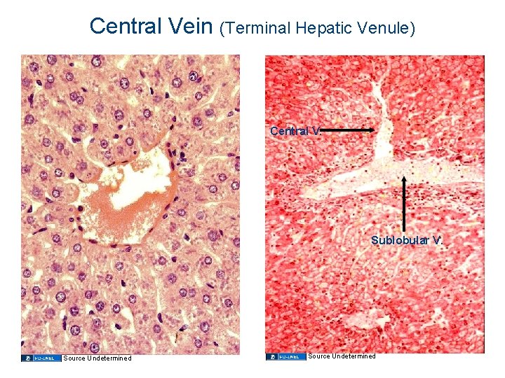 Central Vein (Terminal Hepatic Venule) Central V. Sublobular V. Source Undetermined Central Vein (Terminal Hepatic Venule) Central V. Sublobular V. Source Undetermined