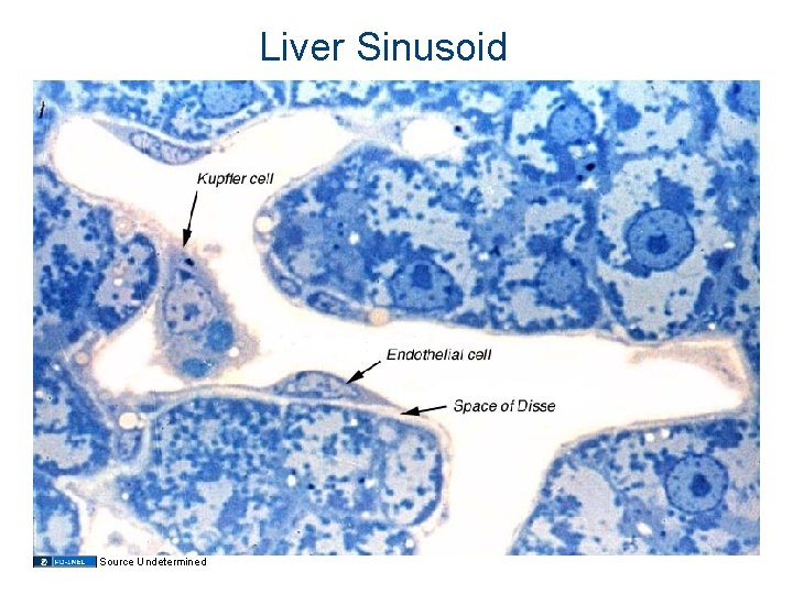 Liver Sinusoid Source Undetermined 