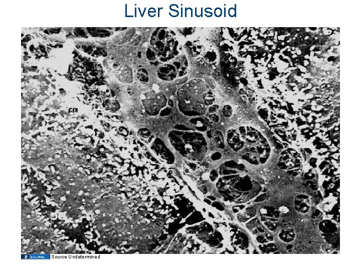 Liver Sinusoid Source Undetermined 