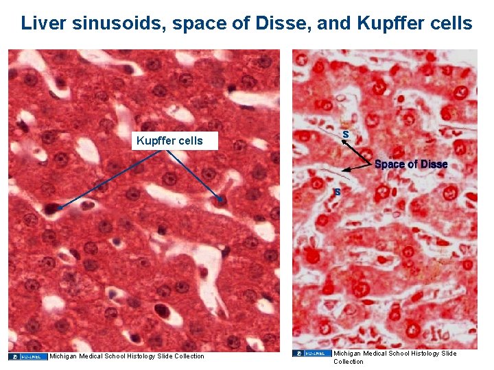 Liver sinusoids, space of Disse, and Kupffer cells s Michigan Medical School Histology Slide