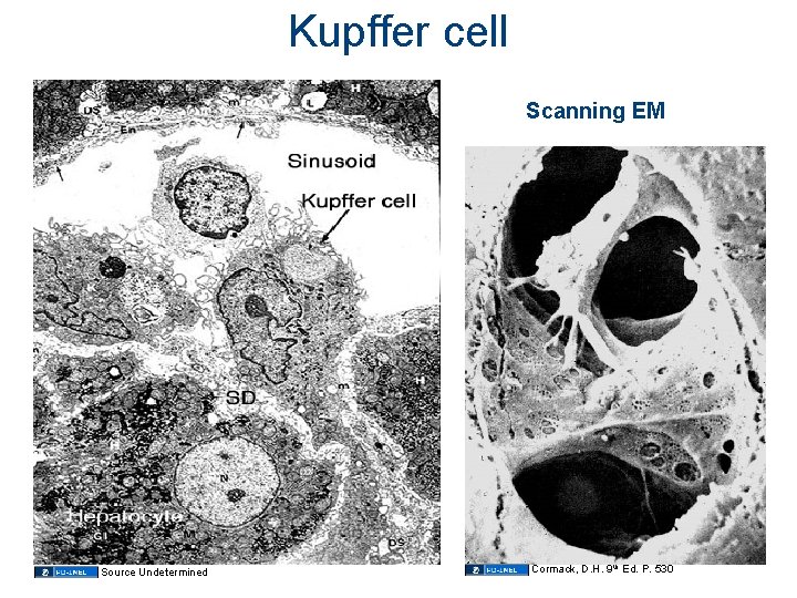 Kupffer cell Scanning EM Source Undetermined Cormack, D. H. 9 th Ed. P. 530 Kupffer cell Scanning EM Source Undetermined Cormack, D. H. 9 th Ed. P. 530