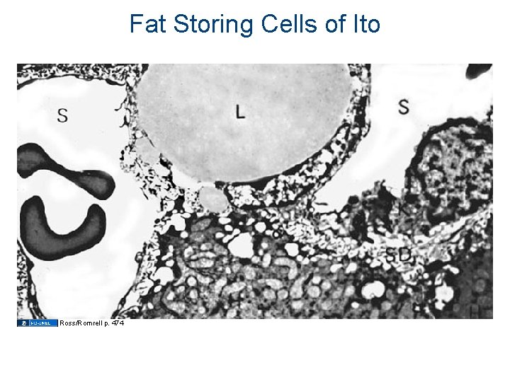 Fat Storing Cells of Ito Ross/Romrell p. 474 