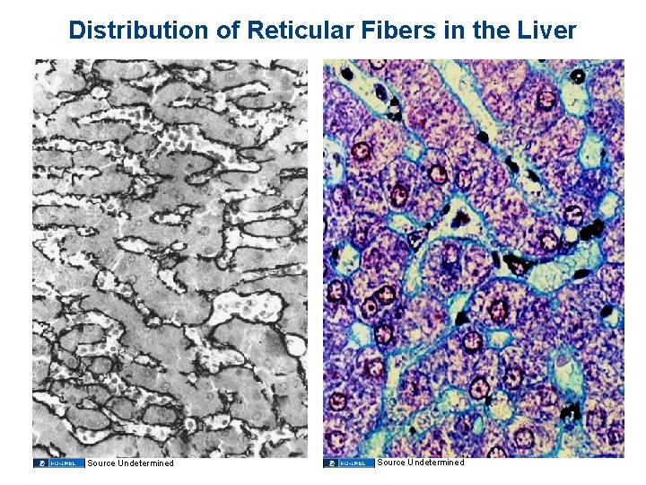 Distribution of Reticular Fibers in the Liver Source Undetermined 