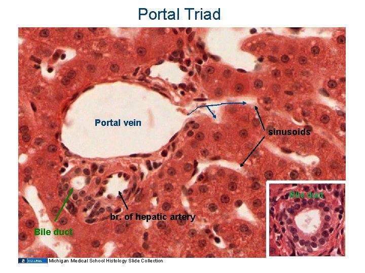 Portal Triad Portal vein sinusoids Bile duct br. of hepatic artery Bile duct Michigan Portal Triad Portal vein sinusoids Bile duct br. of hepatic artery Bile duct Michigan