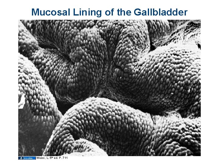 Mucosal Lining of the Gallbladder Weiss, L. 6 th ed. P. 711 