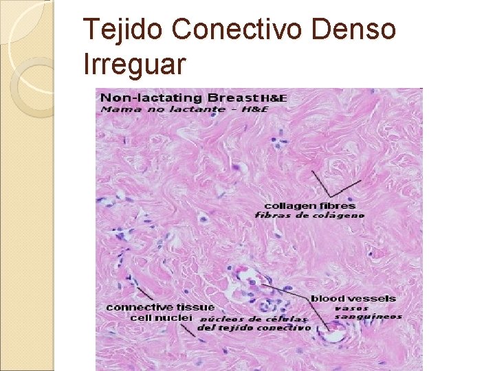 Tejido Conectivo Denso Irreguar 
