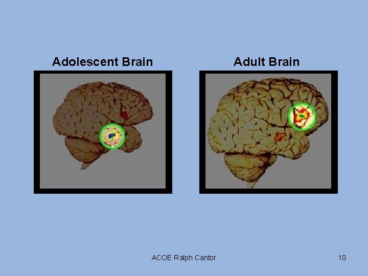 Adolescent Brain ACOE Ralph Cantor Adult Brain 10 