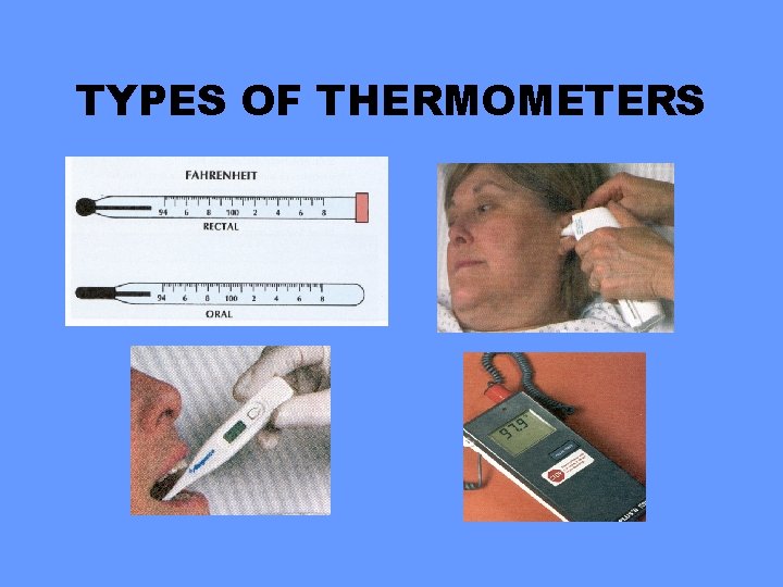 TYPES OF THERMOMETERS 
