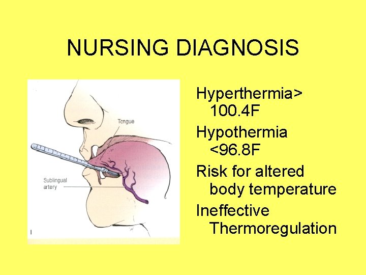 NURSING DIAGNOSIS Hyperthermia> 100. 4 F Hypothermia <96. 8 F Risk for altered body