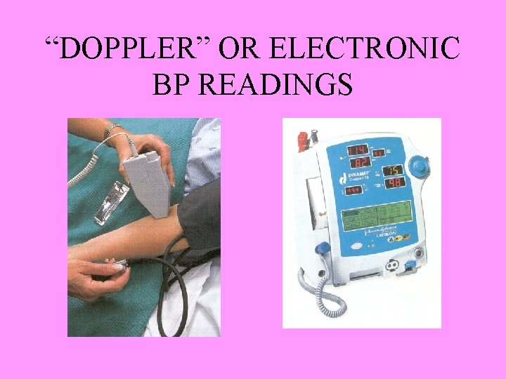 “DOPPLER” OR ELECTRONIC BP READINGS 