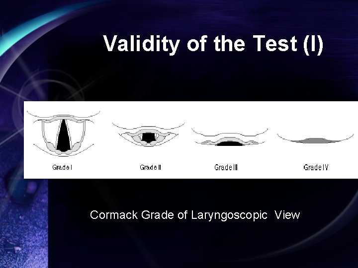 Validity of the Test (I) Cormack Grade of Laryngoscopic View 