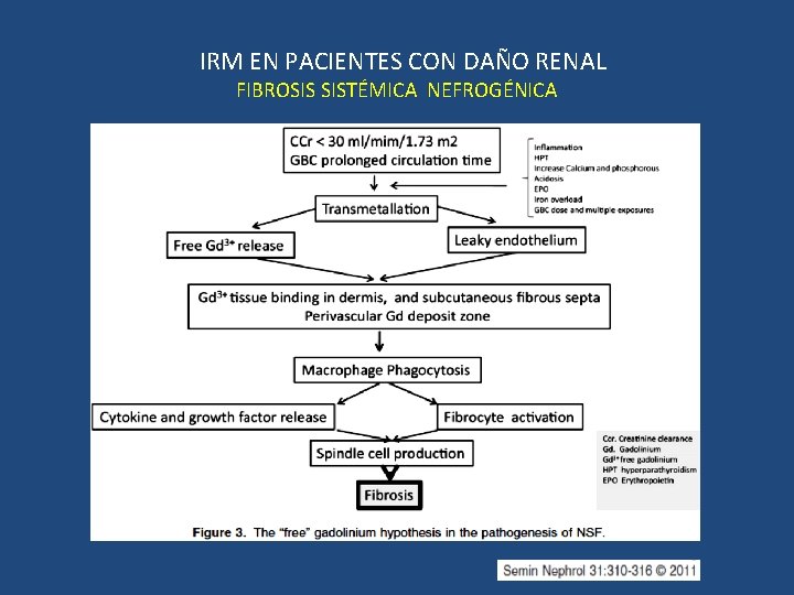 IRM EN PACIENTES CON DAÑO RENAL FIBROSIS SISTÉMICA NEFROGÉNICA 