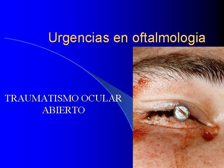 Urgencias en oftalmologia TRAUMATISMO OCULAR ABIERTO 