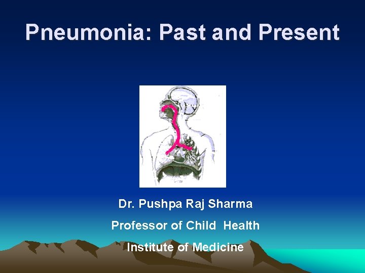 Pneumonia: Past and Present Dr. Pushpa Raj Sharma Professor of Child Health Institute of Pneumonia: Past and Present Dr. Pushpa Raj Sharma Professor of Child Health Institute of