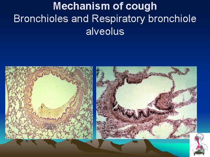 Mechanism of cough Bronchioles and Respiratory bronchiole alveolus Mechanism of cough Bronchioles and Respiratory bronchiole alveolus