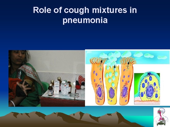 Role of cough mixtures in pneumonia Role of cough mixtures in pneumonia