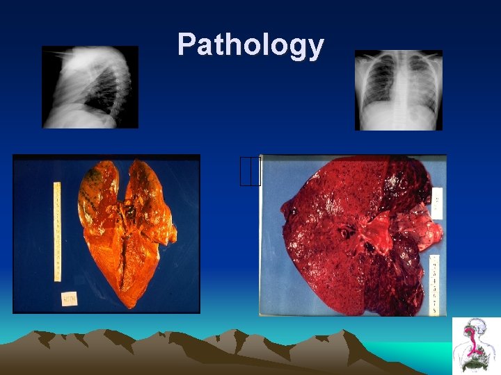 Pathology Pathology