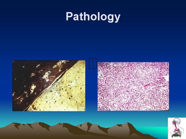 Pathology Pathology