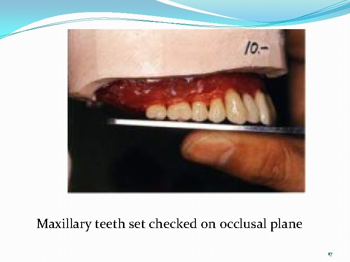 Maxillary teeth set checked on occlusal plane 17 