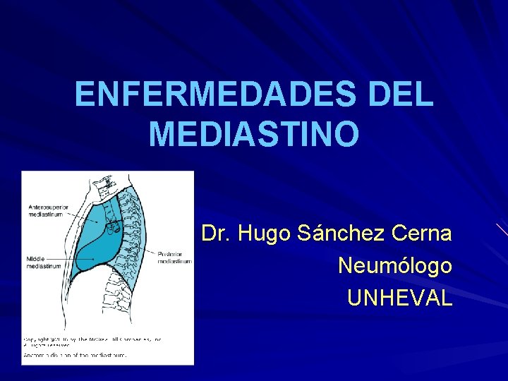 ENFERMEDADES DEL MEDIASTINO Dr. Hugo Sánchez Cerna Neumólogo UNHEVAL 