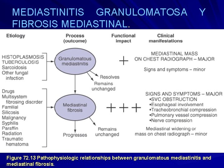 MEDIASTINITIS GRANULOMATOSA FIBROSIS MEDIASTINAL. Y Figure 72. 13 Pathophysiologic relationships between granulomatous mediastinitis and