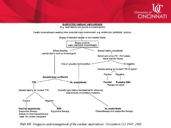Falk RH: Diagnosis and management of the cardiac amyloidoses. Circulation 112: 2047, 2005. 