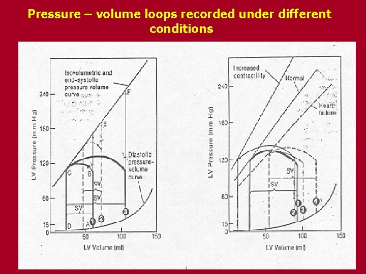 Pressure – volume loops recorded under different conditions 