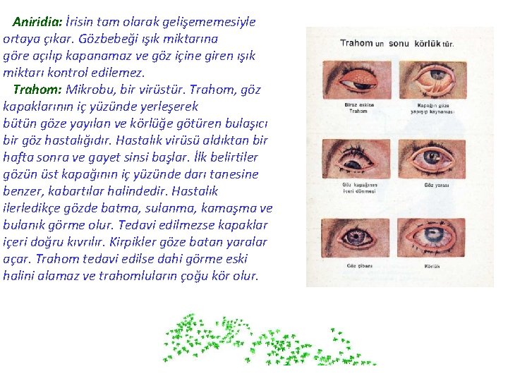 Aniridia: İrisin tam olarak gelişememesiyle ortaya çıkar. Gözbebeği ışık miktarına göre açılıp kapanamaz ve