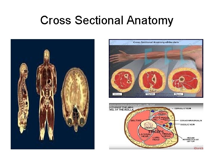 Cross Sectional Anatomy 