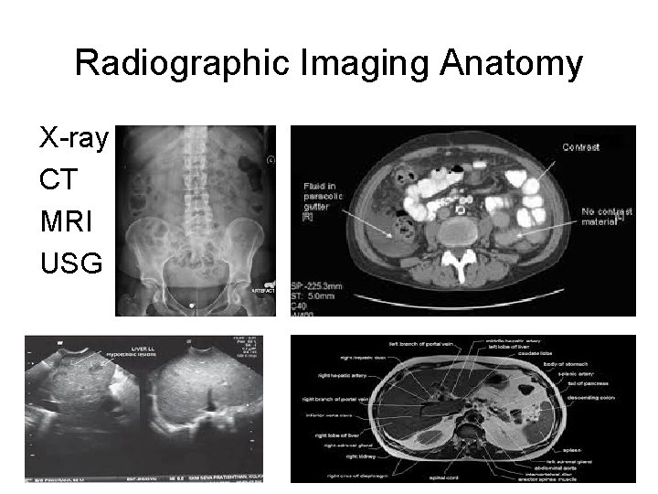 Radiographic Imaging Anatomy X-ray CT MRI USG 