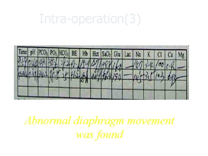 Intra-operation(3) Abnormal diaphragm movement was found 