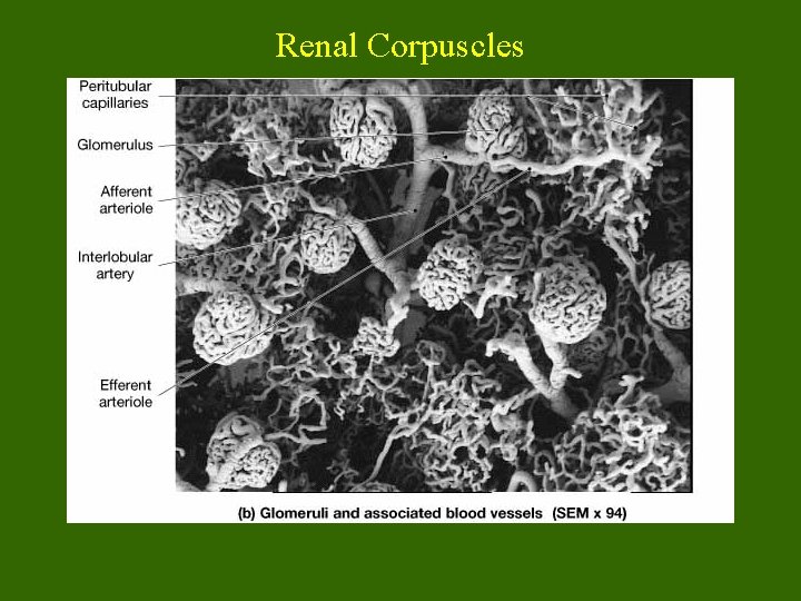 Renal Corpuscles 