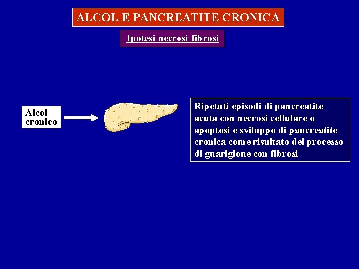 ALCOL E PANCREATITE CRONICA Ipotesi necrosi-fibrosi Alcol cronico Ripetuti episodi di pancreatite acuta con ALCOL E PANCREATITE CRONICA Ipotesi necrosi-fibrosi Alcol cronico Ripetuti episodi di pancreatite acuta con