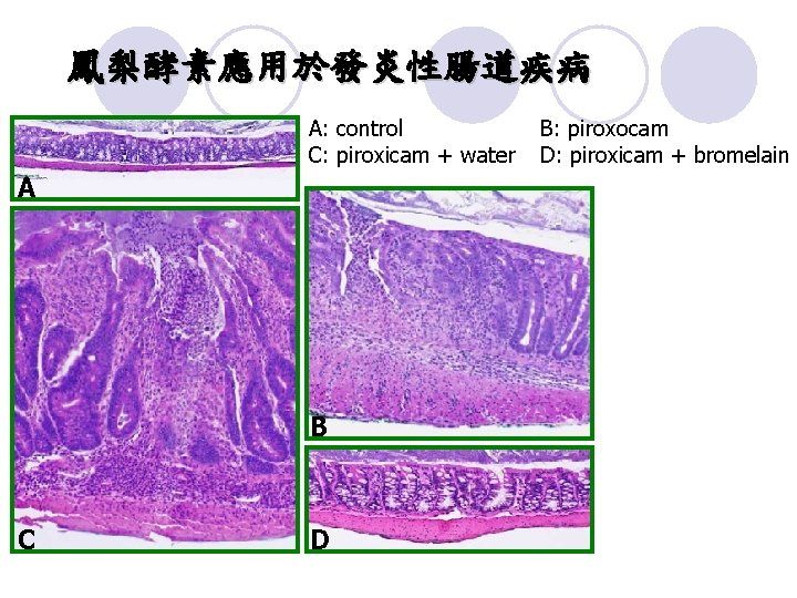 鳳梨酵素應用於發炎性腸道疾病 A: control C: piroxicam + water A B C D B: piroxocam D: