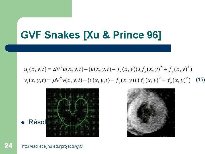 GVF Snakes [Xu & Prince 96] (15) l 24 Résolution: http: //iacl. ece. jhu.